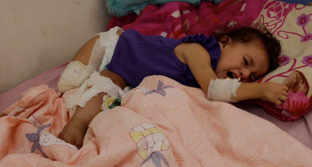Palestinian child Maryam Abu Alba lying on a hospital bed in Gaza.